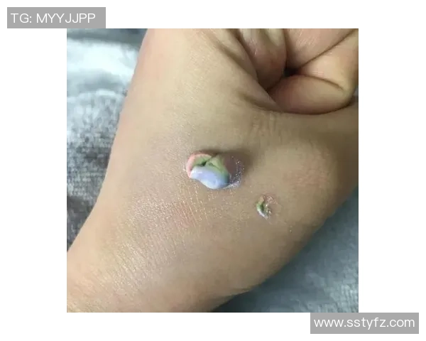 足球明星意外体验鸟屎美食引发热议网友纷纷调侃其味觉冒险之旅