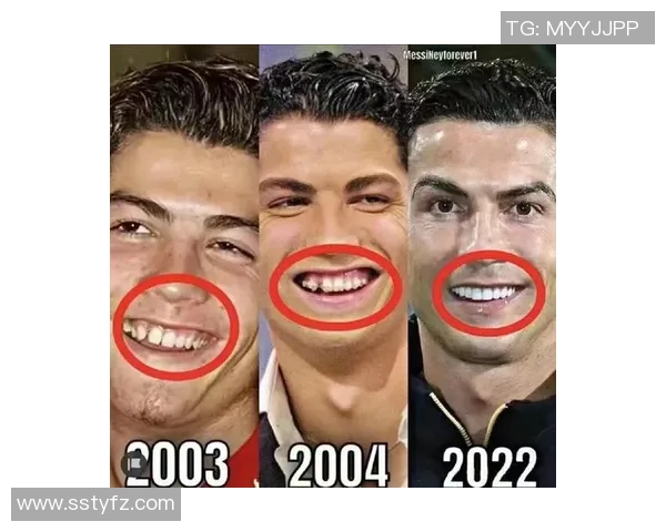 足球明星整牙背后的故事与改变人生的微笑之旅 足球明星整牙背后的故事与改变人生的微笑之旅